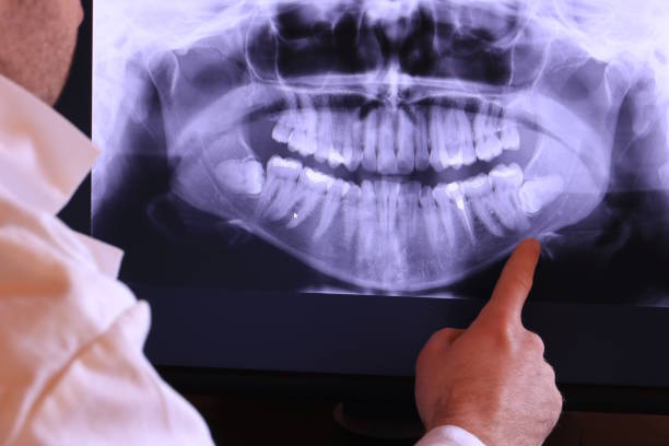 Best Emergency Gum Treatment in Park Hill, OK