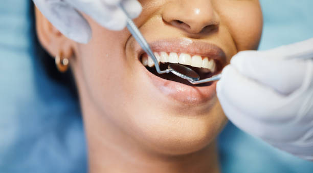 Best Emergency Tooth Extraction in Park Hill, OK