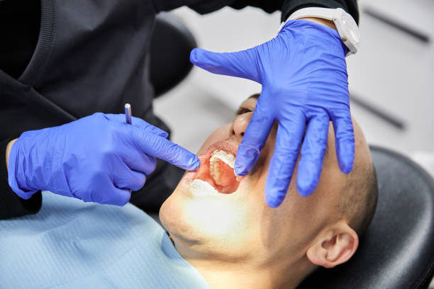 Best Emergency Tooth Extraction in Park Hill, OK